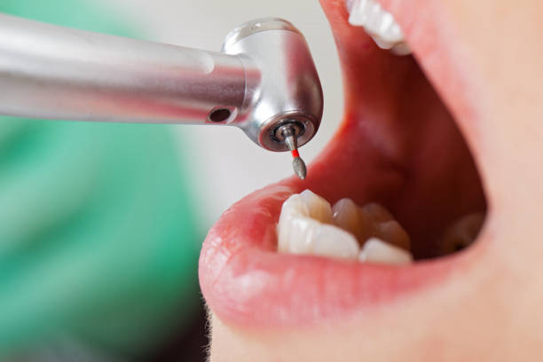 Best Emergency Dentist for Knocked-Out Tooth in Alpine, TX